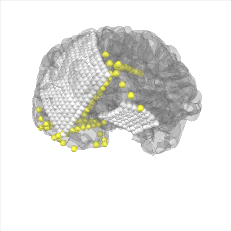 10 ieeg localize