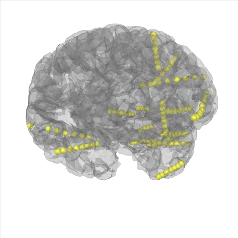 10 ieeg localize