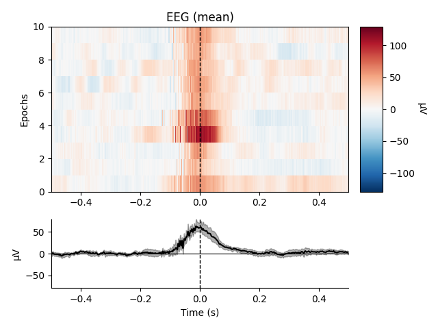 EEG (mean)