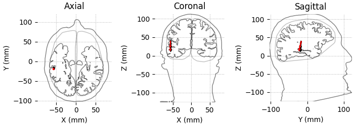 Axial, Coronal, Sagittal