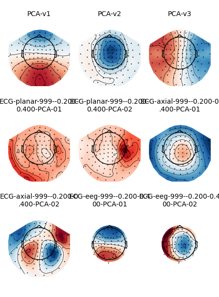 PCA-v1, PCA-v2, PCA-v3, ECG-planar-999--0.200- 0.400-PCA-01, ECG-planar-999--0.200- 0.400-PCA-02, ECG-axial-999--0.200-0 .400-PCA-01, ECG-axial-999--0.200-0 .400-PCA-02, ECG-eeg-999--0.200-0.4 00-PCA-01, ECG-eeg-999--0.200-0.4 00-PCA-02