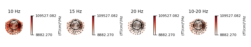 10 Hz, 15 Hz, 20 Hz, 10-20 Hz