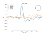 Visualizing Evoked data