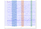 Annotating continuous data