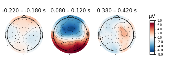 -0.220 – -0.180 s, 0.080 – 0.120 s, 0.380 – 0.420 s, µV