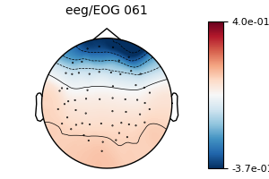 , eeg/EOG 061