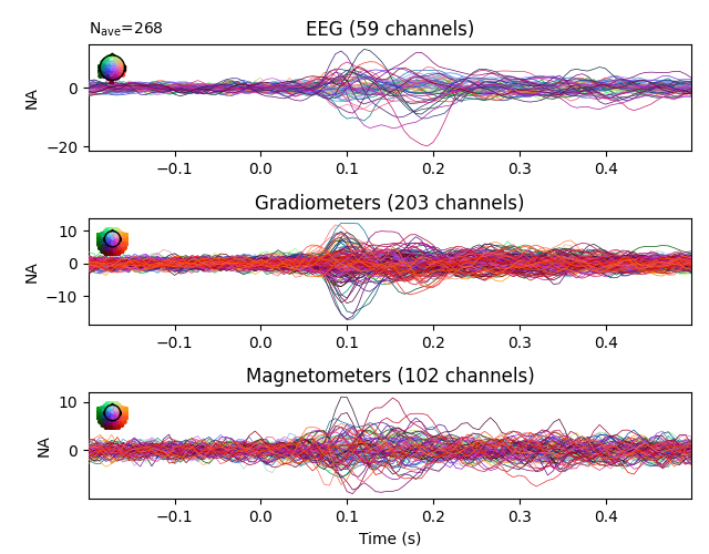 EEG (59 channels), Gradiometers (203 channels), Magnetometers (102 channels)