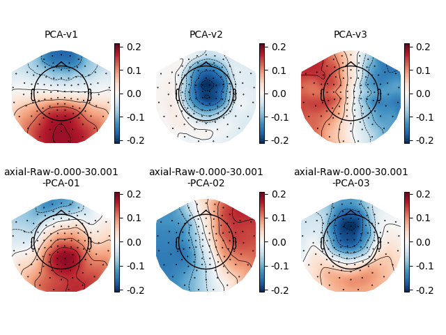 PCA-v1, PCA-v2, PCA-v3, axial-Raw-0.000-30.001 -PCA-01, axial-Raw-0.000-30.001 -PCA-02, axial-Raw-0.000-30.001 -PCA-03