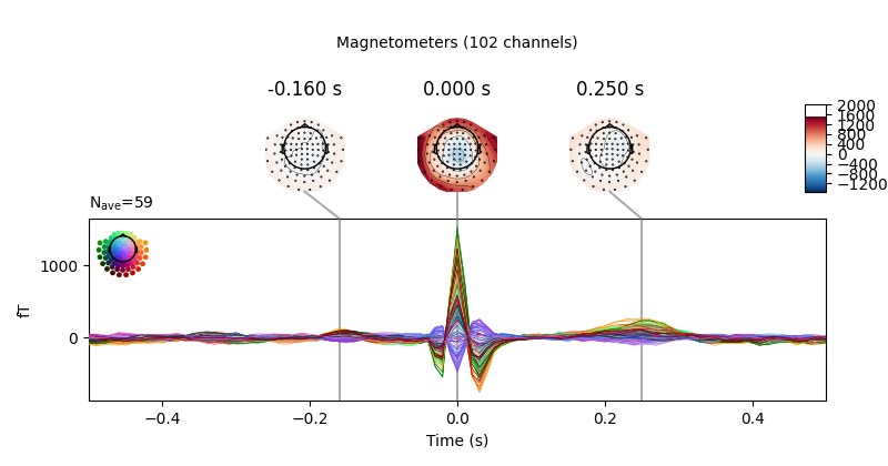 -0.160 s, 0.000 s, 0.250 s