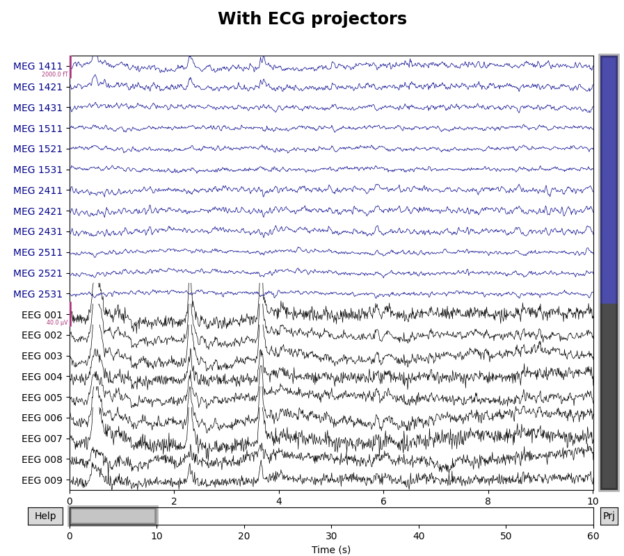 With ECG projectors