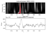 Non-parametric between conditions cluster statistic on single trial power