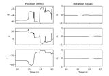 Extracting and visualizing subject head movement