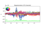 Working with CTF data: the Brainstorm auditory dataset