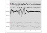 Sleep stage classification from polysomnography (PSG) data