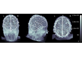 EEG source localization given electrode locations on an MRI