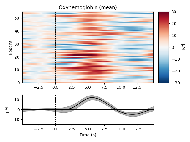 Oxyhemoglobin (mean)