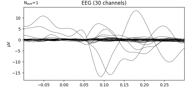 EEG (30 channels)