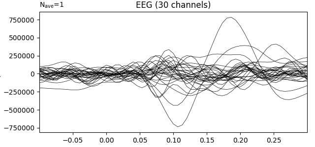 EEG (30 channels)