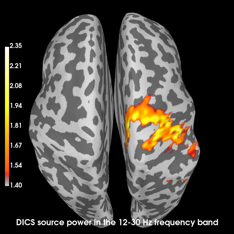 dics source power