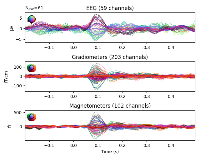 EEG (59 channels), Gradiometers (203 channels), Magnetometers (102 channels)