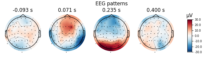 EEG patterns, -0.093 s, 0.071 s, 0.235 s, 0.400 s, µV