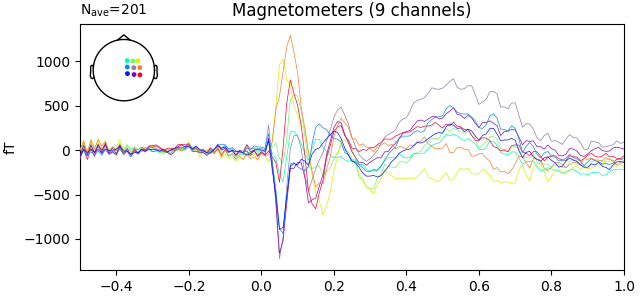 Magnetometers (9 channels)