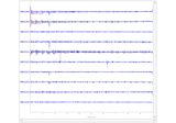 Plot sensor denoising using oversampled temporal projection