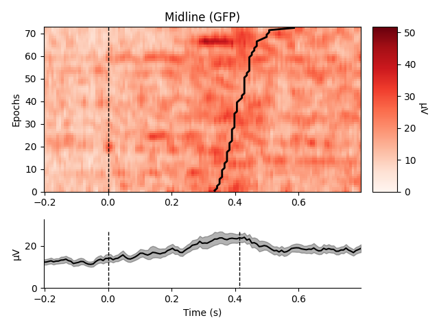 Midline (GFP)