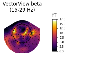 VectorView beta (15-29 Hz), fT