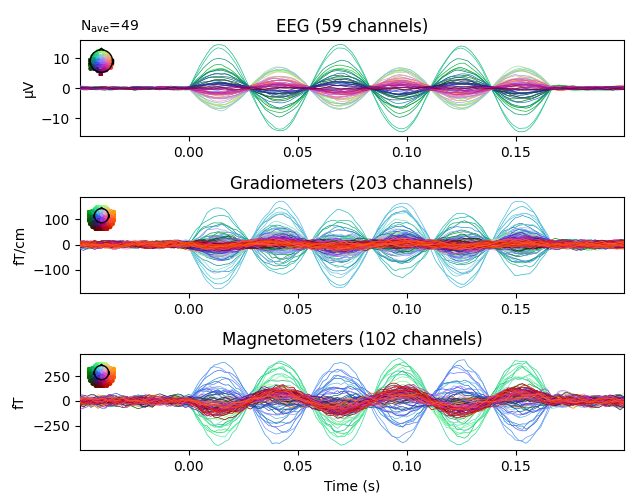 EEG (59 channels), Gradiometers (203 channels), Magnetometers (102 channels)