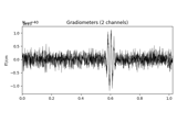 Time-frequency on simulated data (Multitaper vs. Morlet vs. Stockwell vs. Hilbert)