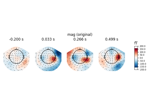 Remap MEG channel types