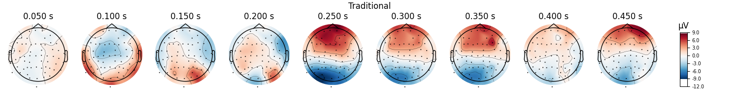 Traditional, 0.050 s, 0.100 s, 0.150 s, 0.200 s, 0.250 s, 0.300 s, 0.350 s, 0.400 s, 0.450 s, µV