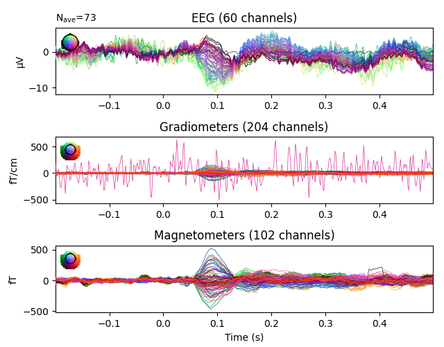 EEG (60 channels), Gradiometers (204 channels), Magnetometers (102 channels)