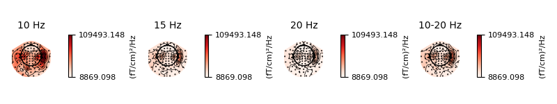 10 Hz, 15 Hz, 20 Hz, 10-20 Hz