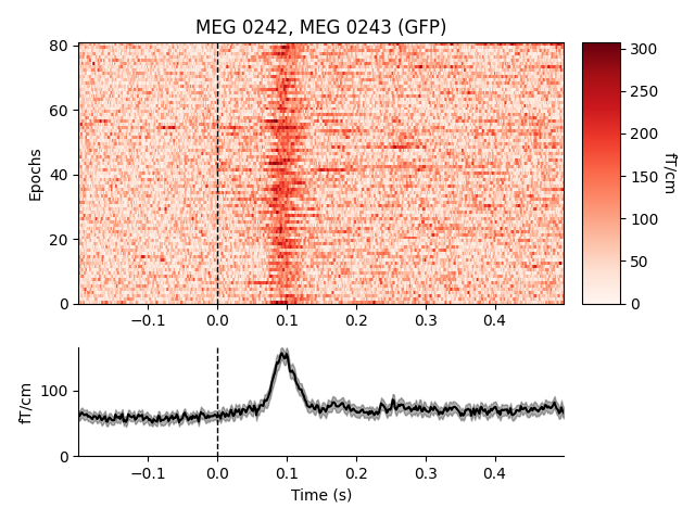 MEG 0242, MEG 0243 (GFP)