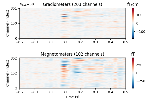 Gradiometers (203 channels), Magnetometers (102 channels), fT/cm, fT