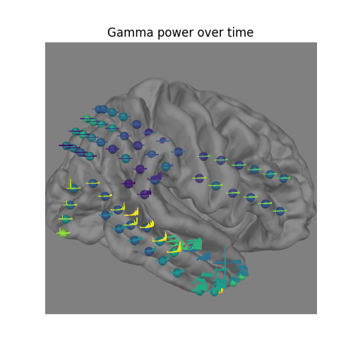 Gamma power over time