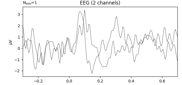 EEG (2 channels)