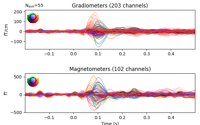 Gradiometers (203 channels), Magnetometers (102 channels)