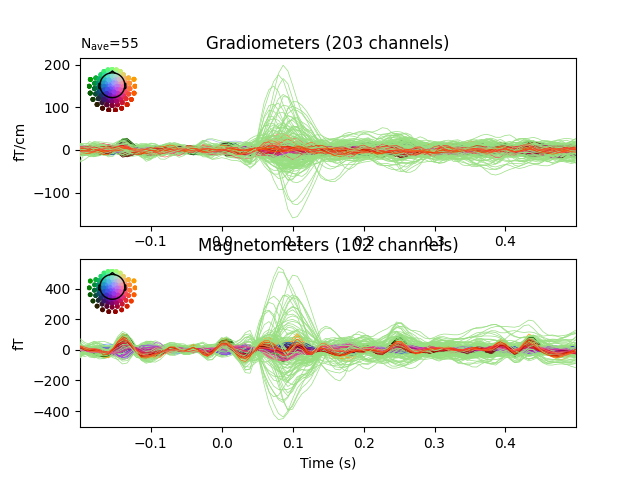 Gradiometers (203 channels), Magnetometers (102 channels)