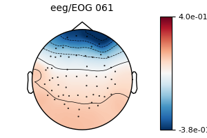 , eeg/EOG 061