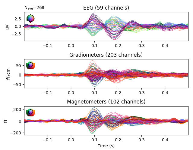 EEG (59 channels), Gradiometers (203 channels), Magnetometers (102 channels)