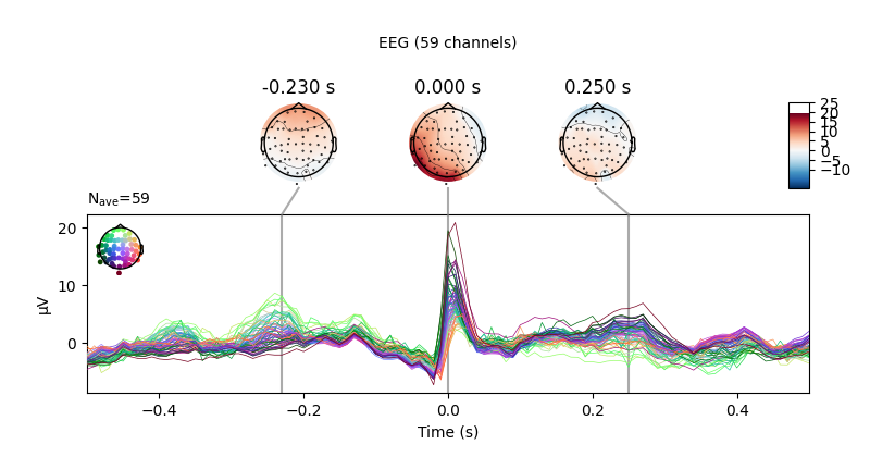 -0.230 s, 0.000 s, 0.250 s