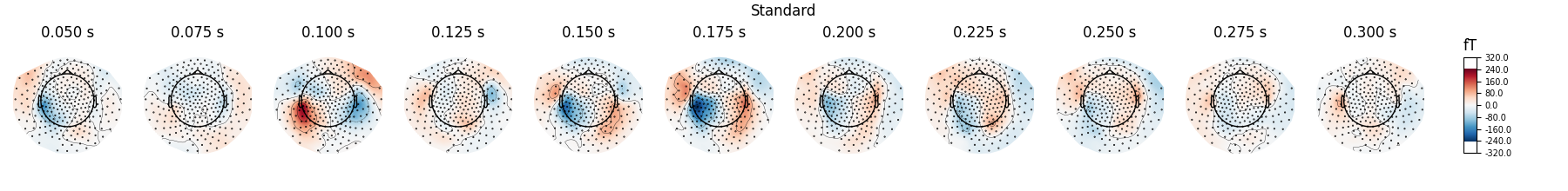 Standard, 0.050 s, 0.075 s, 0.100 s, 0.125 s, 0.150 s, 0.175 s, 0.200 s, 0.225 s, 0.250 s, 0.275 s, 0.300 s, fT