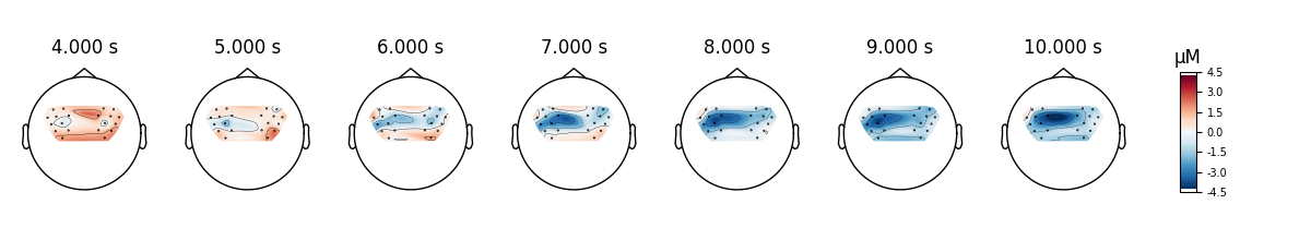 4.000 s, 5.000 s, 6.000 s, 7.000 s, 8.000 s, 9.000 s, 10.000 s, µM