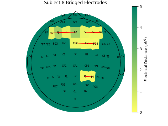 Subject 8 Bridged Electrodes