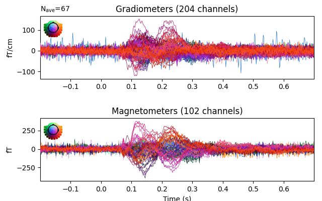 Gradiometers (204 channels), Magnetometers (102 channels)