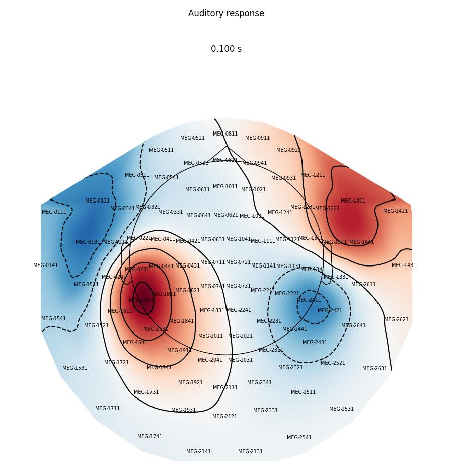 Auditory response, 0.100 s