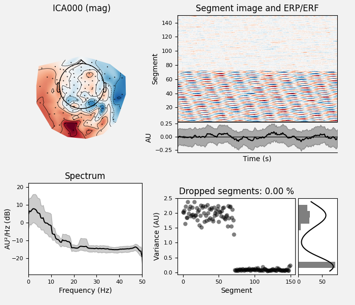 ICA000 (mag), Segment image and ERP/ERF, Spectrum, Dropped segments: 0.00 %